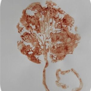 Placenta Print